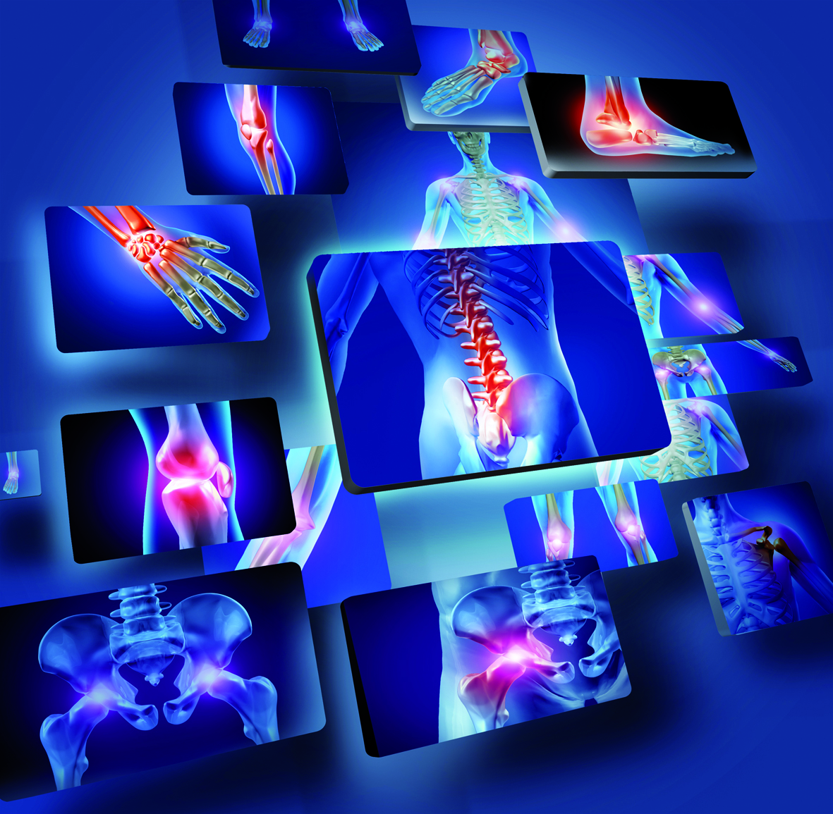 Arthrose : deux fois plus de cas aujourd'hui qu'il y a 50 ans