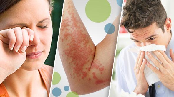Pruebas de alergia cutáneas. Prick test